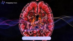 Brain Inflammation Support
