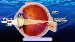 Presbyopia Support Frequencies