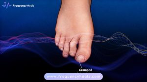 Hammertoe Support