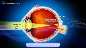 Myopia Support
