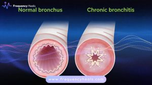 Chronic Bronchitis