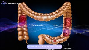 Colon Healing