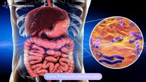 H. Pylori Support