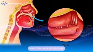 Nose Blockages Relief