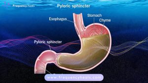 Pyloric Sphincter Support