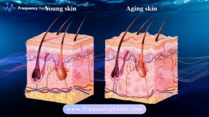 Skin Tightening Support