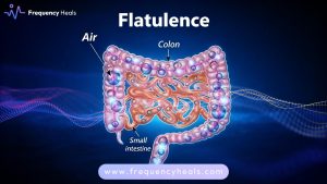 Flatulence Support