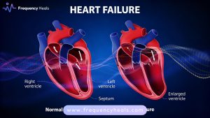 Heart Failure