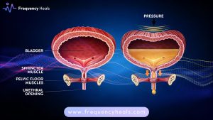 Incontinence Support